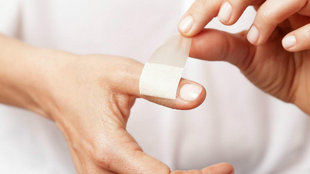 Langkah Aman Merawat Luka Kecil agar Cepat Pulih